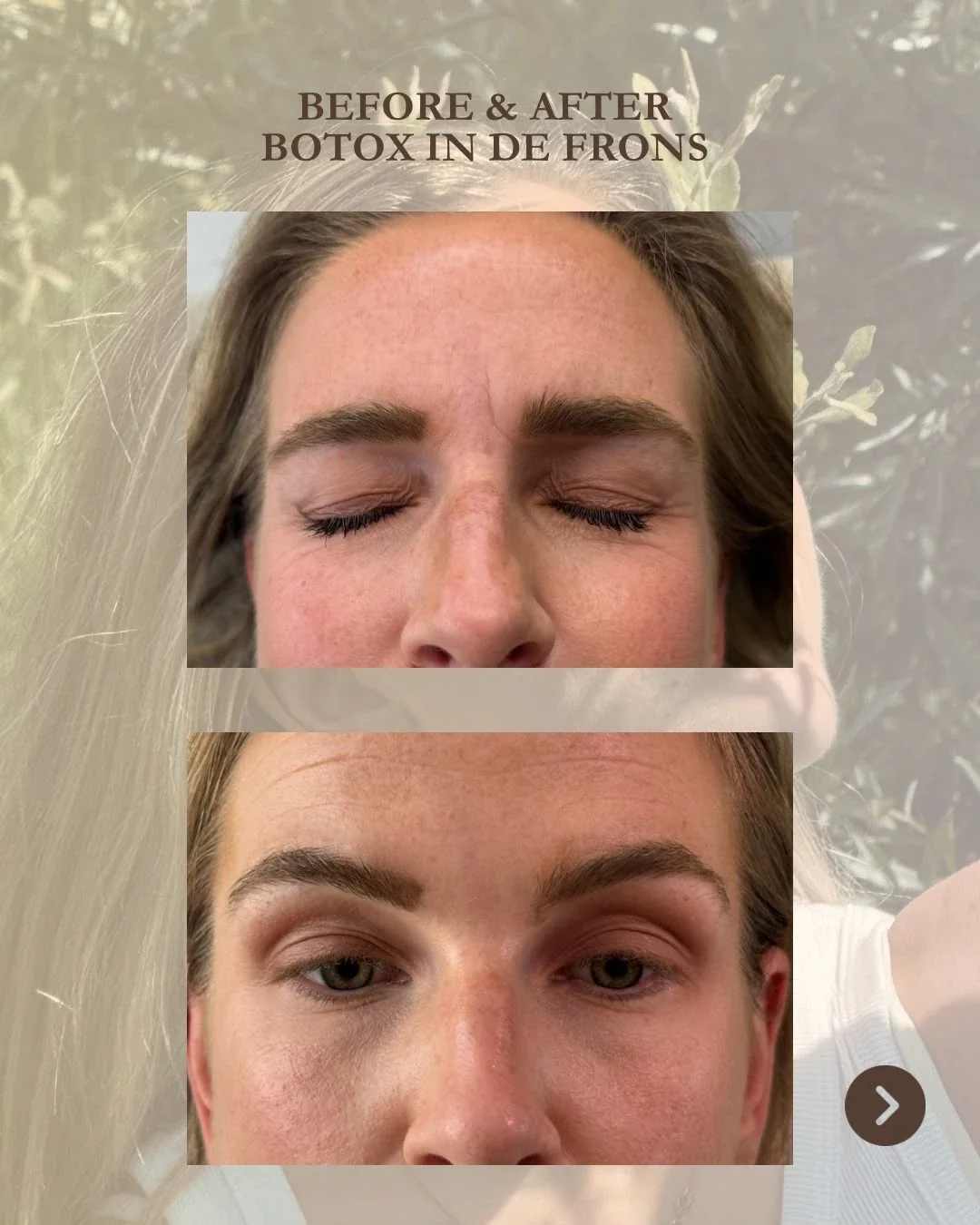 De frons vóór de behandeling