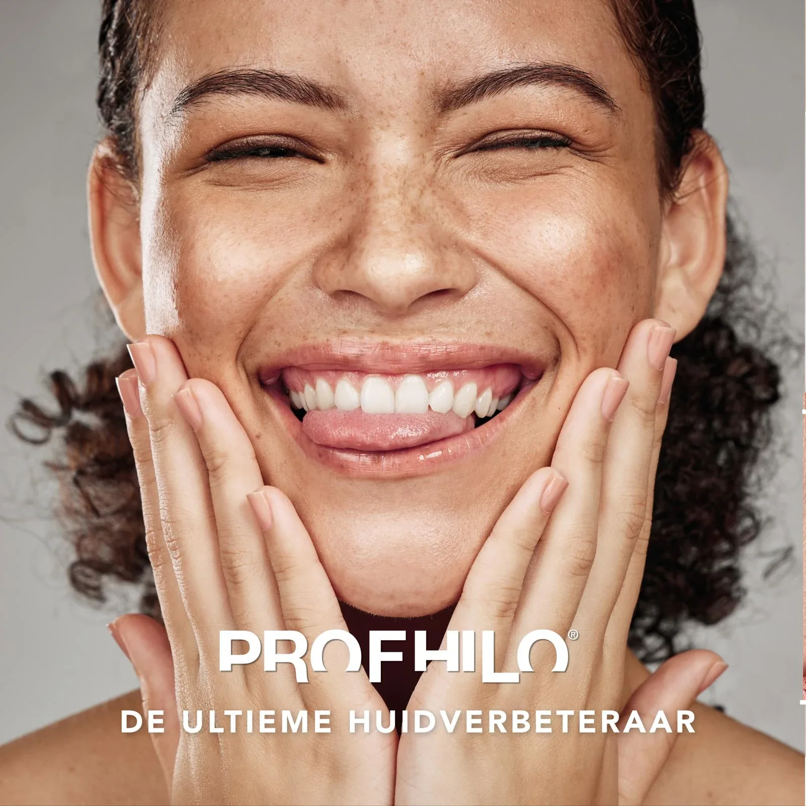 Profhilo · productbeeld
