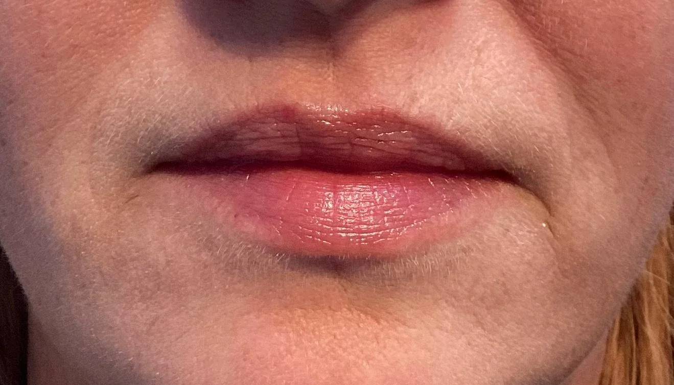 Lippen na de behandeling